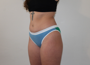 Bikini Brief - Basic Britches